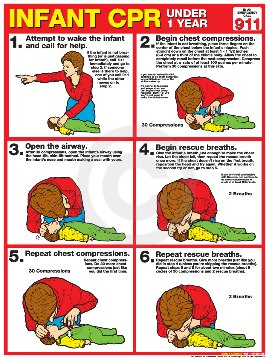 Perform CPR on Unconscious Infant