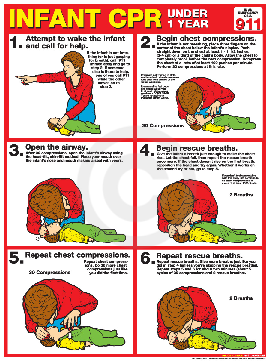 How To Perform CPR On An Unconscious Infant