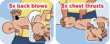 Choking-Infant-3